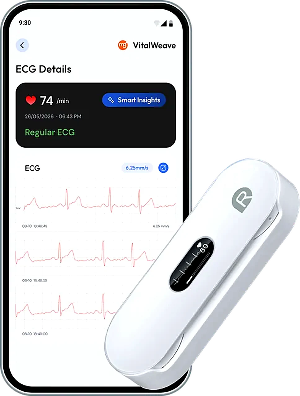 VitalWeave ECG device with the app's ECG view