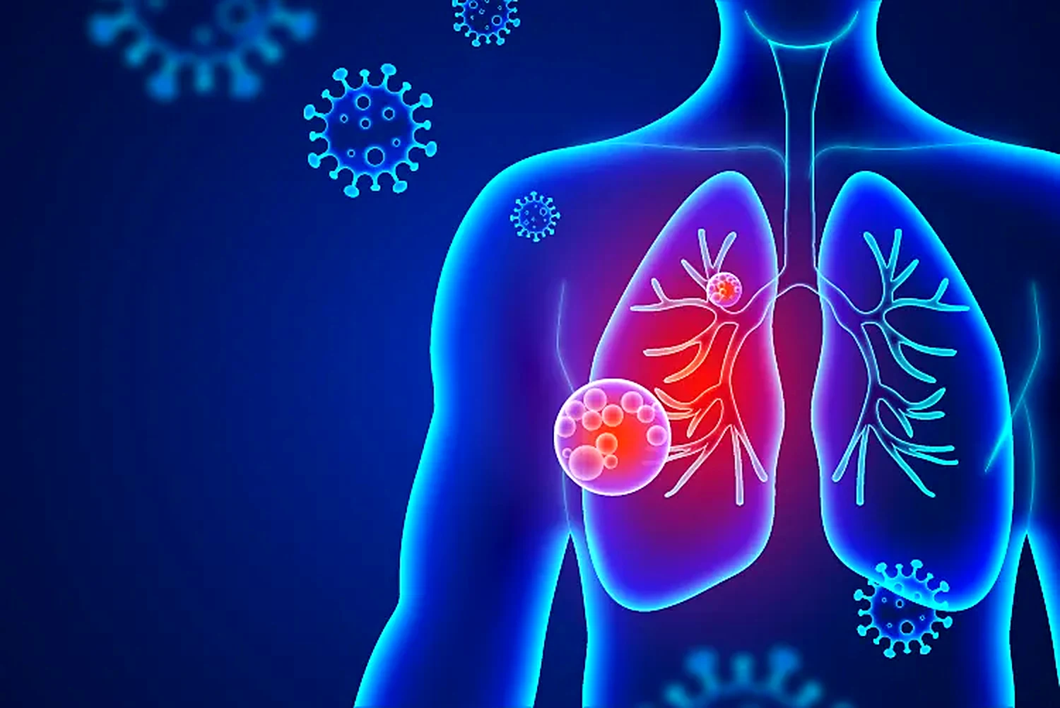 Managing chronic lung conditions: new insights on COPD and asthma