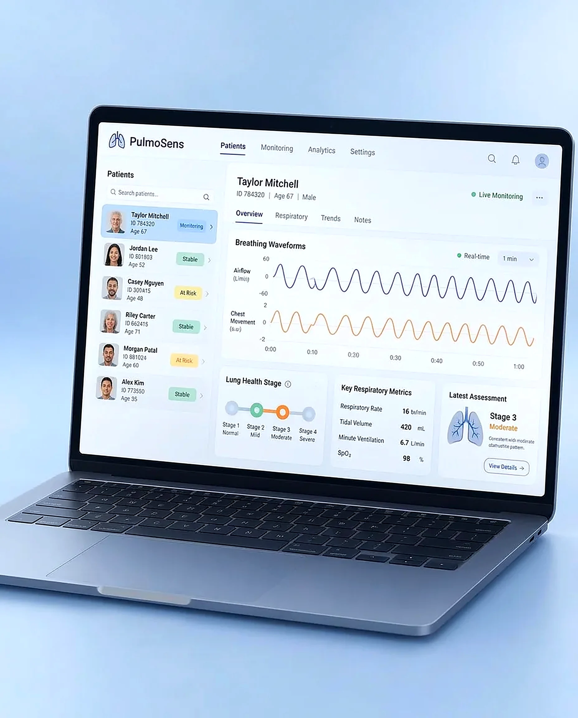 PulmoSens clinical software on a laptop showing patient list, breathing waveforms and lung health staging